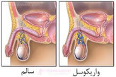 معجون واریکوسل وارداتی/طب سنتی هندی ایرانی با ده گرم ژل رویال---یک کیلو